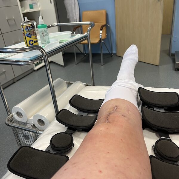 IMG_2959 laura gavurova knee
