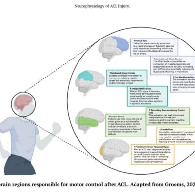 Neurophysiology of ACL Injury 3
