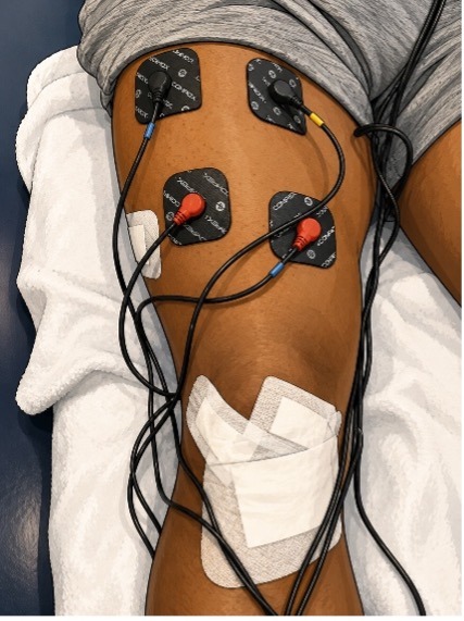 ACL Compex 3 ACL Compex 3